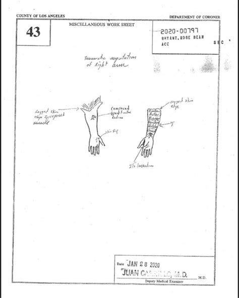 gigi bryants autopsy report|Gigi Bryant Autopsy: Photos, Report, and Cause of Death